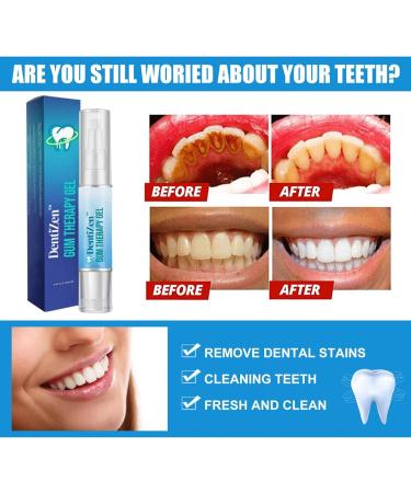 Lovilds Gums Therapy Gel Set - Instant Gum Protection Whitening & Professional Tooth Bleaching - 3 Pieces - Buy Online on SooperMarket.com