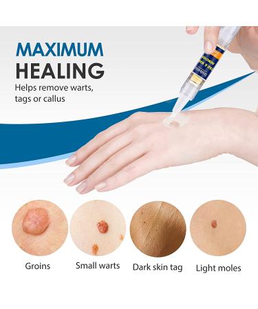 Extra Strength Skin Tag Remover | Wart Removal | Tag Dries and Falls Away | Natural Ingredients | All Skin Types - Buy Online on SooperMarket.com