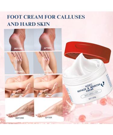 40% Urea Foot Cream For Cracked Heels Urea Foot Cream For Cracked Heels And Dry Skin Urea Lotion Contain Urea 40% Callus Remover Nourishes Soften For Hand & Feet & Body -100 ml - Buy Online on SooperMarket.com