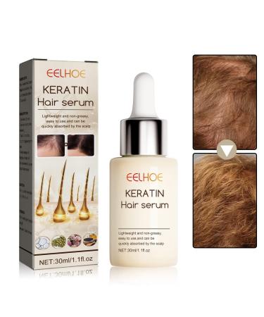 VOLLUCK Hair Growth Oil Hair Oil for Dry Damaged Hair and Growth Hair Thickening Products for Women Nourishes Scalp Thicker Longer Hair Stops Hair Thinning 30ML Hair Thicker