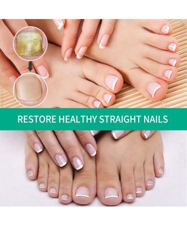 2Pack Kerassentials Toenail Oil and Skin Treatment Set for Nail Care - Buy Online on SooperMarket.com