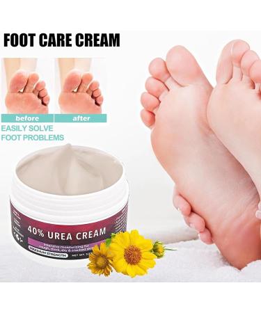 TBeautfave Urea Foot Cream 40% Urea Cream Callus Remover For Dry And Hard Skin Cracked Heel Repair Cream Deep Moisturizing Feet Cream Nourishes Soften for Feet Elbows Knees - Buy Online on SooperMarket.com