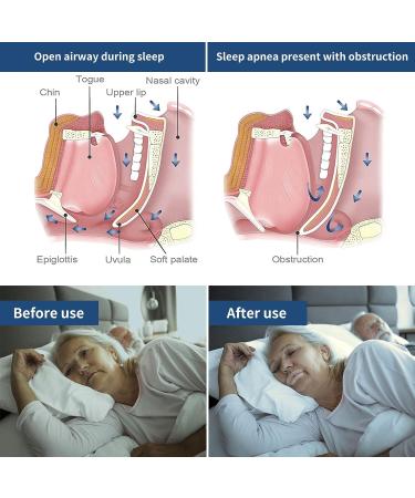 Advanced Gentle Sleep Tape 30 PCS | Mouth Sleep Strips for Better Nose Breathing | Reduce Mouth Breathing | Improve Night Sleep & Snoring Relief - Buy Online on SooperMarket.com