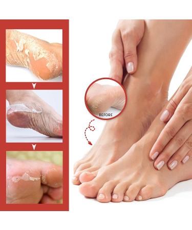 Treatonic Foot Peel Mask - 4 Pairs for Soft Skin, Exfoliates Calluses & Dead Skin - Lavender, Men & Women - Buy Online on SooperMarket.com