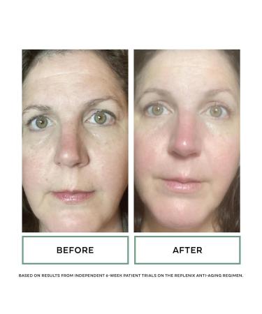 Replenix Anti-Aging Retinol + Bakuchiol Face Serum | Medical-Grade Treatment for Mature Skin | 1 fl. oz - Buy Online on SooperMarket.com