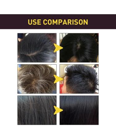 Nmbol Shampoo Hair Dye WL 1 - Buy Online on SooperMarket.com