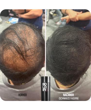 Boldify Scatter Hair Powder for Thinning Hair - Dark Blonde Natural & Invisible 56g - Hides Hair Loss in 15 Sec Perfect for Men & Women - Buy Online on SooperMarket.com