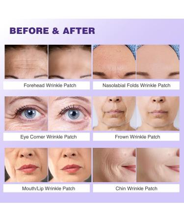 Forehead Wrinkle Patches Face Wrinkle Patches for Face Overnight Face Wrinkle Patches for Forehead Wrinkles Treatment Face Smoothing Patches Anti Wrinkle Patches Wrinkle Remover Strips/840 - Buy Online on SooperMarket.com