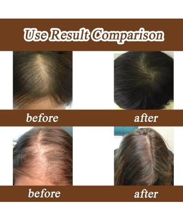 wimony Batana Oil Organic Batana Oil For Hair Growth 100% Pure Raw Natural Batana Oil for Healthy Hair Batana Oil Hair Treatment Promotes Hair Growth Smoother and Shinier Thicker Improve Hair Loss(1PC - Buy Online on SooperMarket.com