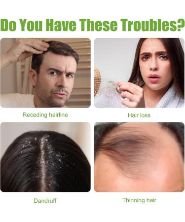 Rosemary Hair Oil(60ml) Rosemary Oil for Hair Growth Diluted Rosemary Essential Oils for Hair Loss & Skin Care Strengthens Hair Nourishes Scalp Hair Loss Improve Oil for Women and Men - Buy Online on SooperMarket.com