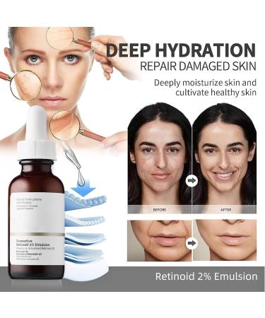 Face Moisturiser Retinoid 2% Emulsion Retinol Serum High Strength for Face Retinol Face Serum Anti Wrinkle Serum Fade Fine Lines Acne Reduced Skin Repair Serum for Women & Men 30ml 1PC Retinoid 2% Emulsion - Buy Online on SooperMarket.com