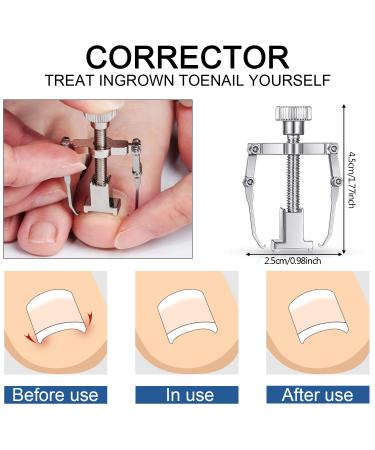 15 Pieces Stainless Steel Ingrown Toenail Tools Set - Nail Clipper Cuticle Cutters Pedicure Kit for Thick Nails (Black) - International Shipping - Buy Online on SooperMarket.com