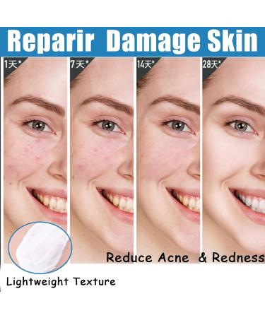 Repairing Face Cream Smoothing Day Cream Anti-Redness Moisturising Cream Firming Face Cream for Sensitive Skin Vitamin B5 Cream Against Acne Brightening & Skin Repair - Buy Online on SooperMarket.com