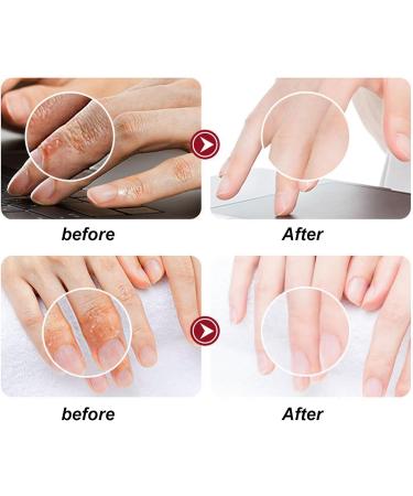 5 Pairs Moisturizing Hand Mask Gloves Effective Exfoliation Smoother Skin Hand Peel Mask Hand Spa Mask for Dry Hands for Home Beauty Salon Repair Rough Skin - Buy Online on SooperMarket.com