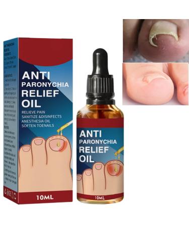 Ingrown Toenail Treatment Correction Drops Nail Growth Treatment Nail Care Ingrowing Toenail Treatment Ingrown Toenail Corrector Treatment for Ingrown Toenail Ingrowing Toenail Improve Toenail Health