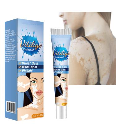 MIELIKKI Vitiligo Cream Reduces White Spots & Improve Skin Pigmentation Natural Ingredients Vitiligo Care Cream for Skin Vitiligo Easy to Use