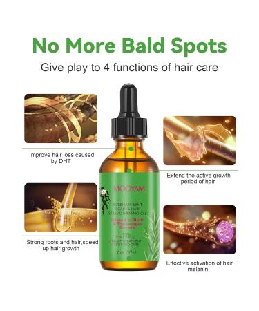 Rosemary Hair Growth Oil & Serum - Dry Scalp Treatment for Women | Hair Thickening & Essential Oil (2OZ) - Boost Hair Growth & Combat Hair Loss - Buy Online on SooperMarket.com