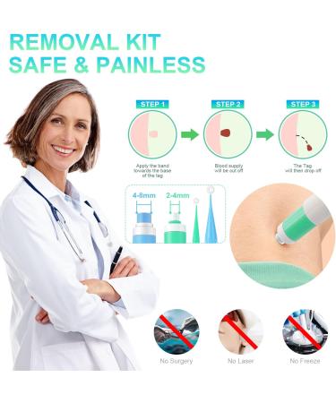 New Version Auto Skin Tag Remover Kit 2-Set Painless Skin Tag Removal Kit Tools for (1-9mm) Skin Tags (includes 100 Removal Bands & 36 Repair Patches & 20 Pcs Cleansing Wipes) Blue Green 2pcs Kit - Buy Online on SooperMarket.com