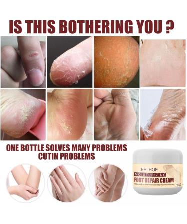 Vegan Foot Cream for Dry Rough & Cracked Feet | Best Callus Care - International Shipping - Buy Online on SooperMarket.com