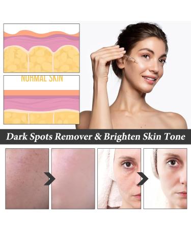 Hyaluronic Acid 2% + B5 30ML Hyaluronic Acid Serum for Face Dark Spot Remover for Face Hyaluronic Acid Face Moisturize Skincare Serum for Face to Plump and Smooth Skin for All Skin Types Skin Care - Buy Online on SooperMarket.com