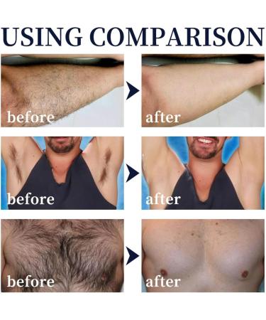Men Hair Removal cream Spray Natural Permanent Hair Removal Spray for Face Underarm Arm Leg Non-Irritating Depilatories Product - Buy Online on SooperMarket.com