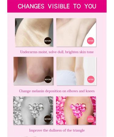 Underarm Whitening Cream Underarm Whitening Products Whitening Cream Skin Whitening Cream Skin Lightening Cream Whitening Cream For Underarm Knees & Elbows & Legs - Buy Online on SooperMarket.com