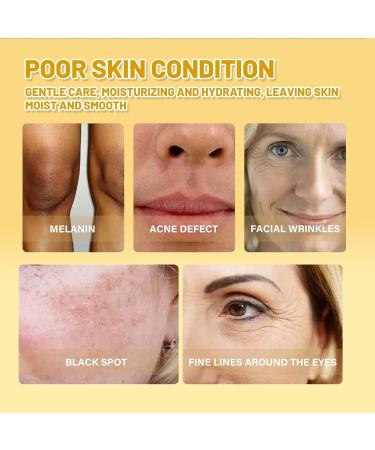 Turmeric Dark Spot Correcting Serum Niacinamide Serum Hydrating Serum Anti Aging Brightening Face Serum For Pure Skin Glow Face Serum Reduce Wrinkles Acne For Face Moisturizes Face Skincare - Buy Online on SooperMarket.com