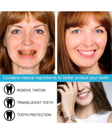 Premium Teeth Whitening Gel - 3 Pack Stain Removal & Breath Freshening - Protect & Brighten Your Smile - Buy Online on SooperMarket.com