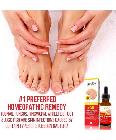 Natural Nail & Toenail Repair Treatment - Extra Strength Drops for Nails, Athlete's Feet, Jock Itch, Ringworm & Skin Rash - USA Made - Buy Online on SooperMarket.com