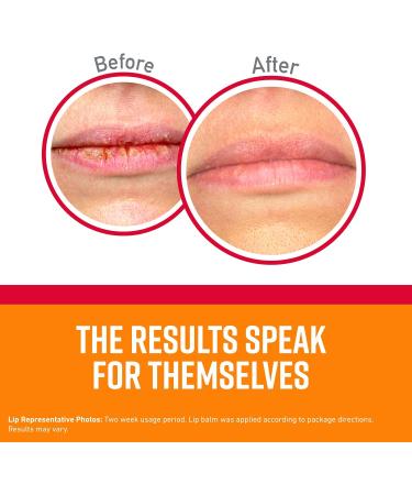 O'Keeffe's Medicated Lip Repair Stick (Pack of 2) | Lip Protectant for Seal & Heal - Buy Online on SooperMarket.com