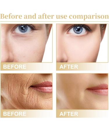 Anti-Aging Eye Lotion - Buy Online on SooperMarket.com