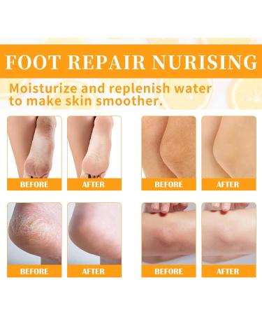 Tongyend Foot Peel Spray Foot Mask Orange Oil Instant Hydrating Nourish Foot Peeling Spray Exfoliator For Cracked Rough Heels & Calluses on Feet Elbows Toes Fingers (Orange) - Buy Online on SooperMarket.com