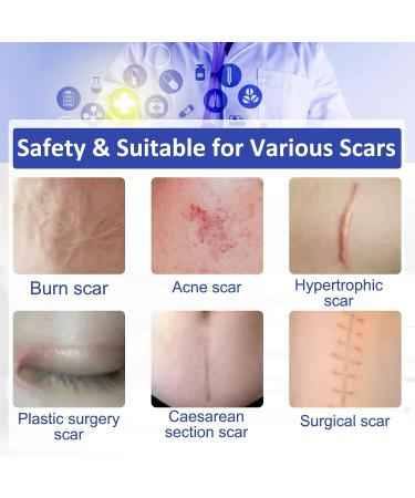 Silicone Scar Sheet Tape - Softens & Flattens Surgery, Injury, Burn, C-Section Scars - Safe & Painless Scar Removal - 1.6 x 120 Inch - Buy Online on SooperMarket.com