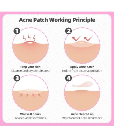 EFLY Hydrocolloid Pimple Patches with Tea Tree Oil & Salicylic Acid Invisible Acne Dots for Face 210 Patches - Buy Online on SooperMarket.com
