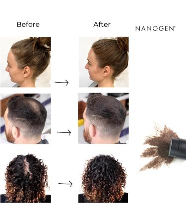 Nanogen Hair Fibres 30 g Dark Brown Dark Brown 30 g (Pack of 1) - Buy Online on SooperMarket.com