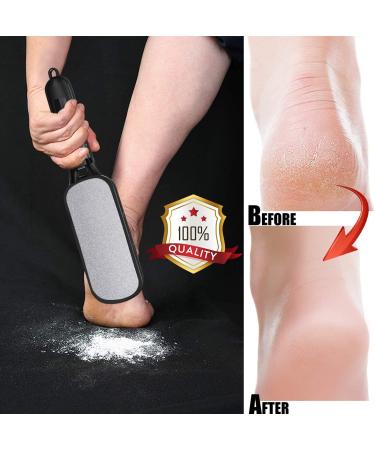 Foot File Callus Remover | Double Sided Scrubber for Dead Skin | Pedicure Tool for Hard Skin, Callus, Plantar Wart, Corn | Skin-Friendly Metal Foot File - Buy Online on SooperMarket.com