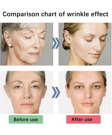 5 Seconds Wrinkle Remover 5 Seconds Retinol Anti-Wrinkle Cream 5 Seconds Anti Wrinkle Face Cream Instant Wrinkle Remover Lifting Moisturizing Facial Cream Tightening Face Cream or Women - Buy Online on SooperMarket.com