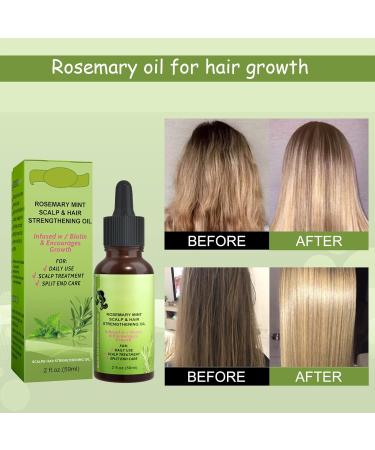 Rosemary Oil for Hair Growth - Essential Oil & Scalp Treatment for Men & Women | Nourishes & Reduces Hair Loss - 59ML - Buy Online on SooperMarket.com