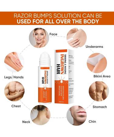 Ingrown Hair Treatment & Razor Bumps Stopper Serum - Alcohol-Free After Shave Solution for Men and Women - Face, Neck, Bikini, Legs, and Underarms - Buy Online on SooperMarket.com