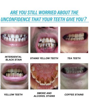 Premium Teeth Whitening Gel - 3 Pack Stain Removal & Breath Freshening - Protect & Brighten Your Smile - Buy Online on SooperMarket.com