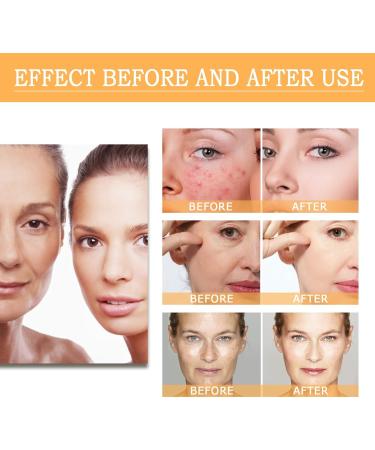 Glycolic Acid Toner Glycolic Acid Toning Resurfacing Glycolic Acid Peeling 7% Glycolic Acid Peeling Toner Toning Solution Glycolic Acid 7% Toner Peeling Toner for Body Face Skin with Dark Spots - Buy Online on SooperMarket.com