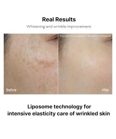 Buy Peptide 11 Botulinum Multi Recovery Ampoule 30ml - Anti-Aging Skin Treatment for Global Shipping - Buy Online on SooperMarket.com