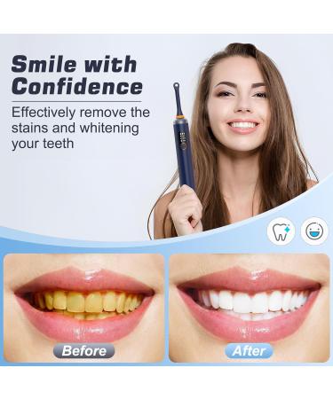 HassoKon Tooth Polisher Kit for Stain Removal & Teeth Whitening - Blue - Buy Online on SooperMarket.com