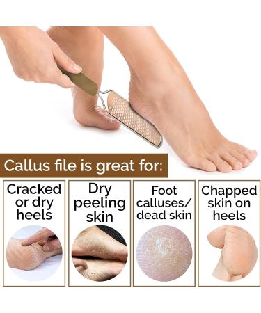 PrettyClaw Callus Remover Foot File - Pedicure Tool for Dead Skin & Corn Removal with 3 Blades, Free Pouch & Nail File - Buy Online on SooperMarket.com