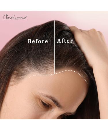 Just Nutritive Women's Hair Treatment Oil - Nourishing & Strengthening for Thinning Hair 4 oz - SLS & Chemical Free Ideal for Hair Loss Regrowth - Buy Online on SooperMarket.com