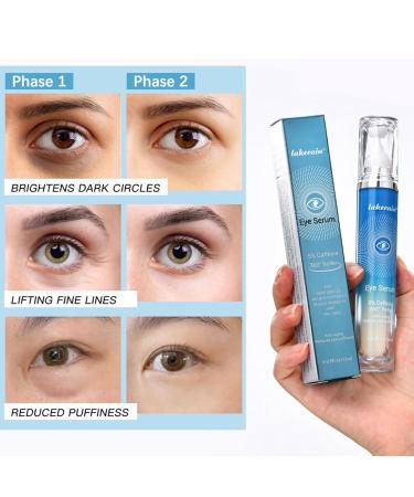 Under Eye Cream with 5% Caffeine & Retinol - Dark Circle Treatment Anti-Aging Serum with 360 Massage Roller for Bags Wrinkles & Puffiness - Buy Online on SooperMarket.com