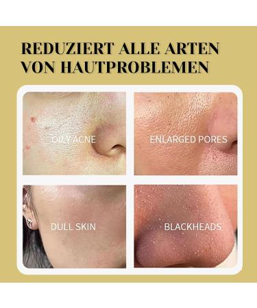 Dead Sea Mask Deep Cleansing Face Mask Skin Care Improve Blackheads Acne Dark Spots Even Skin Tone Face Mask Control Oil Refining Pores (Turmeric) - Buy Online on SooperMarket.com