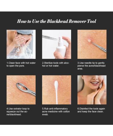 BEZOX Blackhead Remover Tools Pore Extractor Kit Set of 3 Stainless Pimple Popper Facial Tools with Metal Storage Case 3 pcs 1.0 - Buy Online on SooperMarket.com