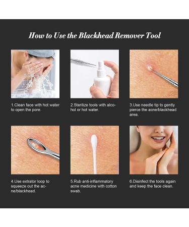 BEZOX Blackhead Tweezer and Acne Needle Set - Stainless Steel Comedone Extractor Kit - Buy Online on SooperMarket.com