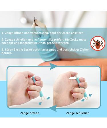Nepfaivy Ticks for Dogs Cats & Humans - 2 Set Tick Tweezers for Safe Removal of Ticks of Every Size - Simple & Effective Solutions for Pets and Kids - Buy Online on SooperMarket.com